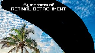 2: What are the symptoms of Retinal Detachment/ RETINAL DETACHMENT/#retinaldetachment