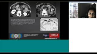 CT Imaging of bowel trauma by Dr Chethan SM