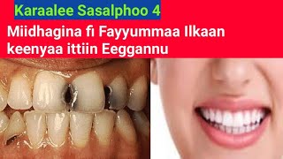 Karaawwan sasalphoo ilkaan keenya ittiin midhagsannu 4 | 4 ways to prevent dental caries #omn #oromo