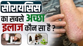 Treatment for psoriasis | Psoriasis ka sabse achha ilaaj kya hai | skin treatment for men