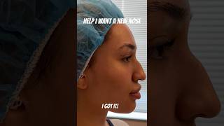 Rhinoplasty by Dr. Truesdale! Check out Season 1 episode 3 of Beyond The Surface here on YouTube