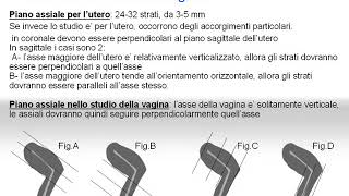 Corso RM FAD 2015 -    pelvi femminile parte 2