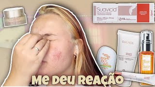 PAREI DE USAR A SUAVICID | MEU MELASMA VOLTOU! | Ket Brinhol ✨