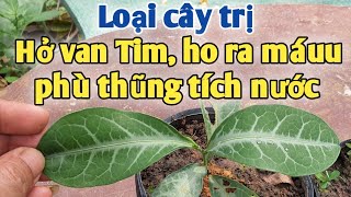 Bài thuốc hổ trợ trị Hở van tim, ho ra máuu.PHAN HẢI Vlog