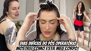 Dias Difíceis do Pós Operatório de Abdominoplastia + Lipo e Como está meu CORPO!