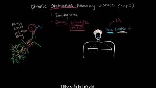 What is chronic bronchitis Final   Respiratory system diseases   NCLEX RN   Khan Academy