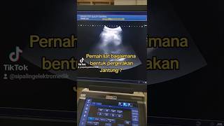 How heart is pictured by the Diagnostic Ultrasound (USG) #tech #healthcare #cardiac #imaging