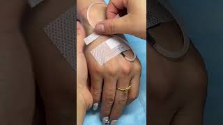 IV INSERTION MATHOD 💉🩺||#health #ivinfusion #viral #hospital #shorts