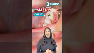 CUIDADO CON LAS CARIES⚠️