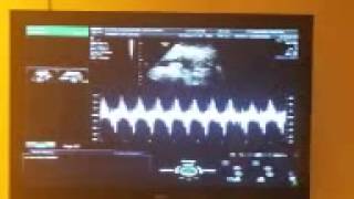 23 week ultrasound pt 4