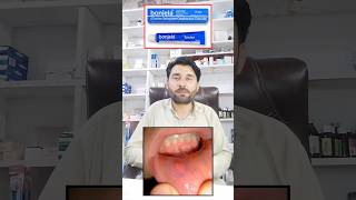 bonjela Gel uses | mou zakham ka gel | mouth ulcer treatment | #viralvideo #viral #shortviral short