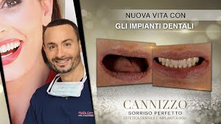 Nuova Vita con gli Impianti Dentali - Studio Cannizzo