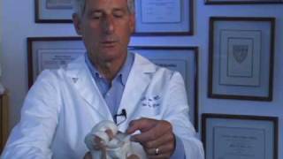 Meniscus Transplant for Arthritis