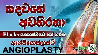 හදවතේ අවහිරතා/Blocks යතාතත්වයට පත් කරන ඇන්ජියෝප්ලාස්ටි/Angioplasty| MLTAnushikaPerera