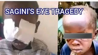 BABY SAGINI'S EYE GAUGED TRAGEDY,DCI INVESTIGATIONS IN KISII AS THE BABY TO BE RELEASED IN HOSPITAL.