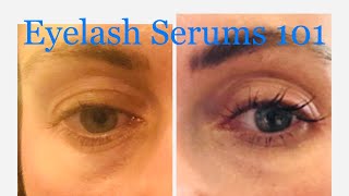 Eyelash Serums 101: Get Yours Growing Today!