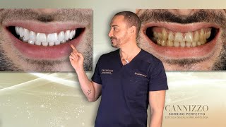 Gli interventi di estetica dentale del Dott. Gianpaolo Cannizzo