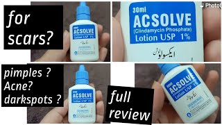 ACSOLVE lotion Review