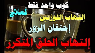 العلاج النهائي والفعال لإحتقان الزور وإلتهاب الحلق المتكرر وإلتهاب اللوزتين عند الأطفال