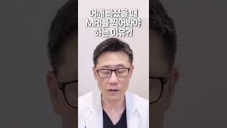 어깨가 빠졌을 때 MRI 를 찍어봐야 하는 이유? ㅣ 어깨 빠졌을 때 병원 가야 하나요 #가자연세병원