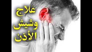 أفضل ثلاث علاجات لطنين الأذن