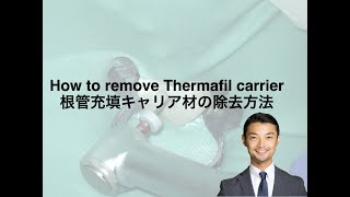 How to remove Thermafil carrier：根充キャリア材の除去方法