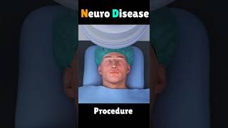 Neuro Disease  #shorts