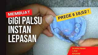 Cara Membuat 3 Gigi Palsu Atas Dengan Cepat Dan Murah