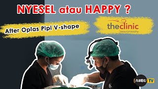 CARA MUDAH TIRUSIN PIPI V SHAPE - TESTIMONI THE CLINIC BEAUTYLOSOPHY DOKTER DANU MAHANDARU SPBP