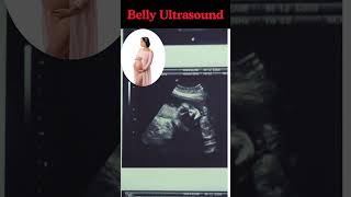 Baby moving in belly #shortvideo #pregnancy #viralvideo #trending #information