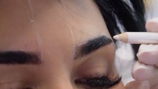 MY EYEBROW TRANSPLANT Experience @maithaabduljalil | Maitha Abduljalil