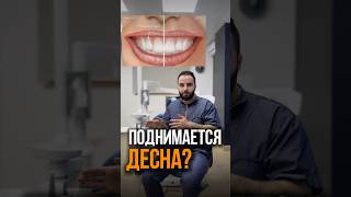 УБЫЛЬ ДЕСНЫ? ПОДНИМАЕТСЯ ДЕСНА?