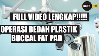 CARA NGILANGIN LEMAK PIPI V SHAPE PERMANEN - OPERASI BEDAH PLASTIK BUCCAL FAT PAD VIDEO NO SENSOR!