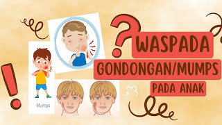 Gondongan atau MUMPS pada anak - Cara mencegah dan megobati Gondongan pada anak