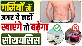 ✅ गर्मियों में सोरायसिस रोगी क्या खाएं | What should psoriasis patients eat in summer?