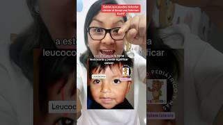 Sabías que puedes detectar cáncer con tan solo tomar una foto con flash? #cancer  #niños  #pediatra