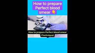 How to prepare Perfect blood smear film #hematology #labstatus #labtech #bloodtest #a380f #smear