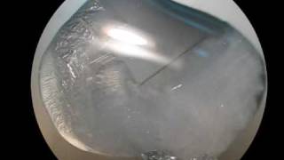 Growing Sodium Thiosulfate Crystals