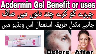 Acdermin Gel How to use | Acne treatment with Acdermin Gel | Best Acne Treatment Gel in Pakistan