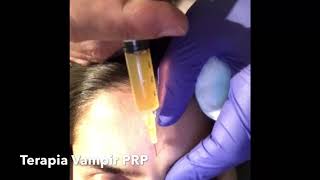 PRP - Terapia vampir