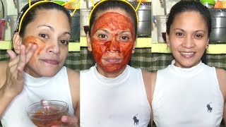 Turmeric and Baking Soda Face Scrub Acne Scars Treatment