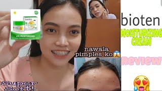 BIOTEN MOISTURIZING CREAM. | HONEST REVIEW!!! |ANTI ACNE.