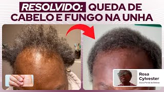 Anos sofrendo com QUEDA DE CABELO e FUNGO NAS UNHAS resolvido em 1 mês com Óleos Essenciais