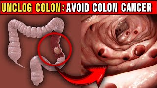 These Fruits Unclog Colon and Prevent Colon Cancer