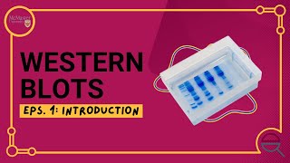 Introduction to the Western Blot