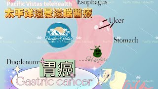 胃癌，惡性腫瘤，黑大便，幽門螺旋桿菌，PV telehealth Vlog 2023