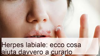 Herpes labiale: ecco cosa aiuta davvero a curarlo