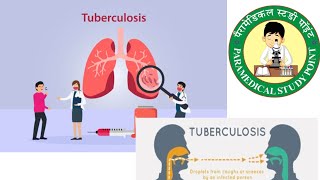 TUBERCULOSIS🫁