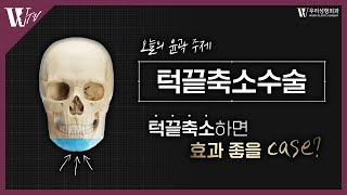 턱끝축소수술 효과가 좋은 CASE : 윤곽 케이스 분석