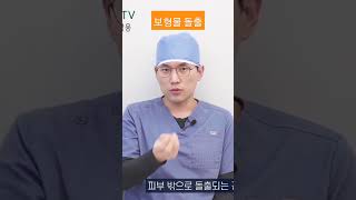 #코성형 #코수술 #보형물돌출 #엘자실리콘 #코성형부작용